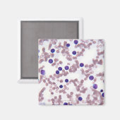 Lymphozytenzellen Magnet (Vorderseite/Rückseite)