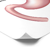 Magenband Gewichtsverlust Operation Poster (Ecke)