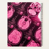 Magenta MRI: Eine Axiale Sicht auf das Gehirn Planer (Rückseite)