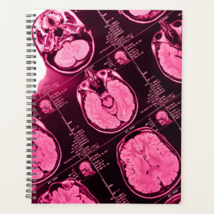 Magenta MRI: Eine Axiale Sicht auf das Gehirn Planer