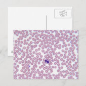 Malariablutzellen Postkarte (Vorne/Hinten)