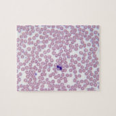 Malariablutzellen Puzzle (Horizontal)