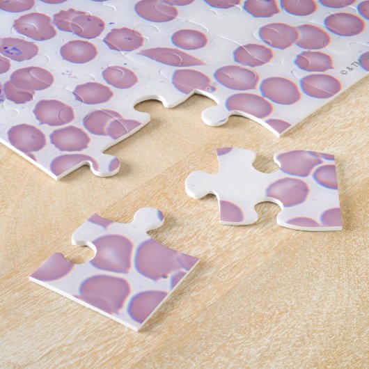 Malariablutzellen Puzzle (Seite)