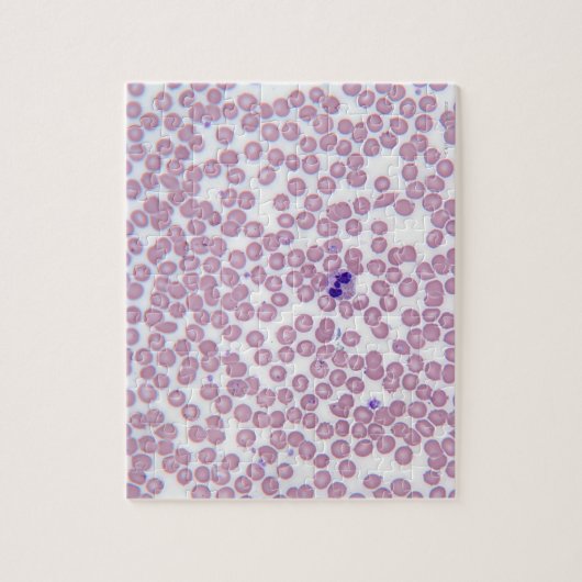 Malariablutzellen Puzzle (Vertikal)