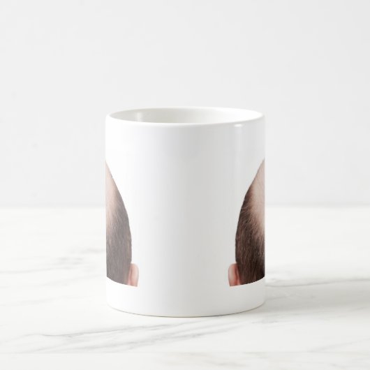 Männlicher Muster Baldness Kaffeetasse (Mittel)