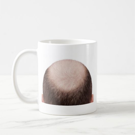 Männlicher Muster Baldness Kaffeetasse (Links)