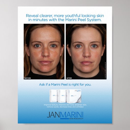 Marini Peel System 8x10" Poster (Vorne)