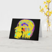 Mark's eingefärbtes MRT Karte (Gelbe Blume)