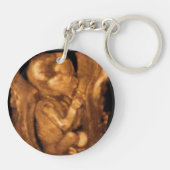 Maternity Sonogram Custom Foto Schlüsselanhänger (Rückseite)