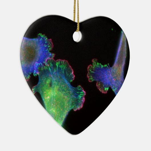 Mäuseembryonale Fibroblasten Keramikornament (Rechts)