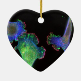 Mäuseembryonale Fibroblasten Keramikornament