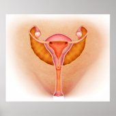 Medizinische Aufklärung weiblicher Genitalorgane 1 Poster (Vorne)