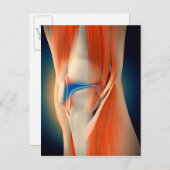 Medizinische Illustration: Entzündung im Knie Postkarte (Vorne/Hinten)