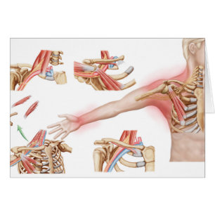 Medizinische Illustration im Detail Thorakische Ou