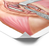 Medizinische Illustration mit Carpal Tunnel Poster (Ecke)