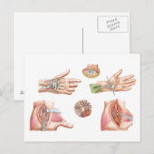 Medizinische Illustration mit Carpal Tunnel Postkarte (Vorne/Hinten)