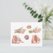 Medizinische Illustration mit Carpal Tunnel Postkarte (Stehend Vorderseite)