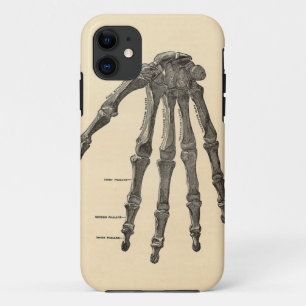 Medizinischer Anatomie-Handknochen iPhone Fall Case-Mate iPhone Hülle