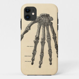 Medizinischer Anatomie-Handknochen iPhone Fall Case-Mate iPhone Hülle