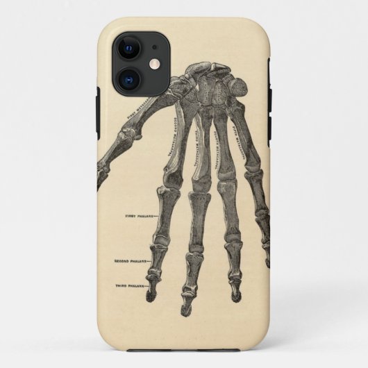 Medizinischer Anatomie-Handknochen iPhone Fall Case-Mate iPhone Hülle (Rückseite)