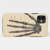 Medizinischer Anatomie-Handknochen iPhone Fall Case-Mate iPhone Hülle (Rückseite (Horizontal))