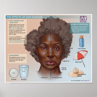 Melalogic Die Auswirkungen von Sonnenschäden Mediz Poster