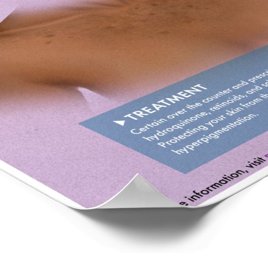 Melalogic Hyperpigmentierung Medizinisches Poster (Ecke)