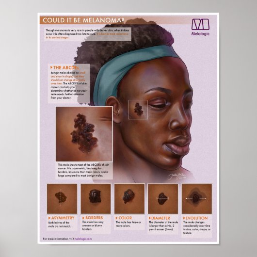 Melalogic Melanoma Medical Poster (Vorne)