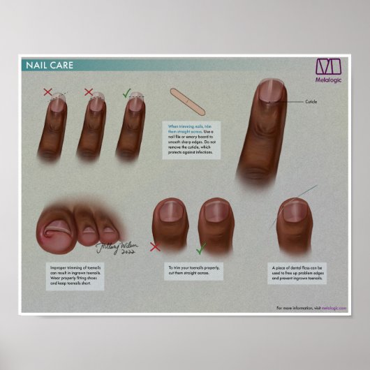 Melalogic Nail Care Medical Poster (Vorne)