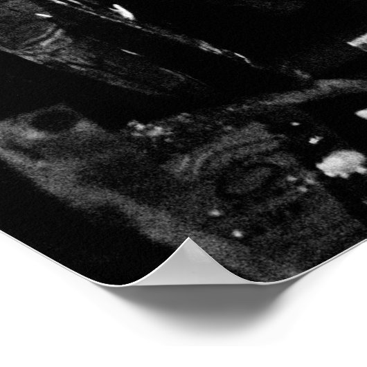 Melbourne Laneway Poster (Ecke)