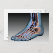 Menschenfett mit Nervensystem 1 Postkarte (Vorne/Hinten)