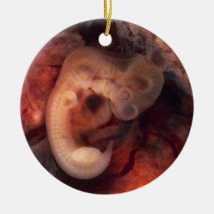 Menschlicher Embryo-7. Woche Schwangerschafts-5. Keramikornament