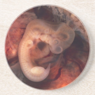 Menschlicher Embryo-7. Woche Schwangerschafts-5. Sandstein Untersetzer