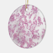 Mikroskop-Foto des menschlichen Bluts mit Keramikornament (Links)