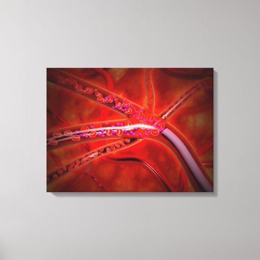 Mikroskopische Ansicht des zu injizierenden Arznei Leinwanddruck (Vorderseite)