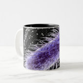 Mikroskopische Ansicht einer helicobacter Zweifarbige Tasse (Vorderseite Links)