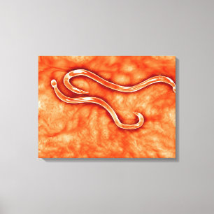 Mikroskopische Ansicht von Hookworm 2 Leinwanddruck