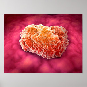 Mikroskopische Ansicht von Tumor 3 Poster