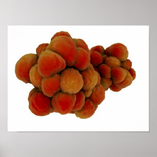 Mikroskopische Ansicht von Tumor 4 Poster