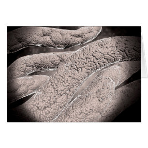 Mikroskopische Darstellung der Corncob-Formation