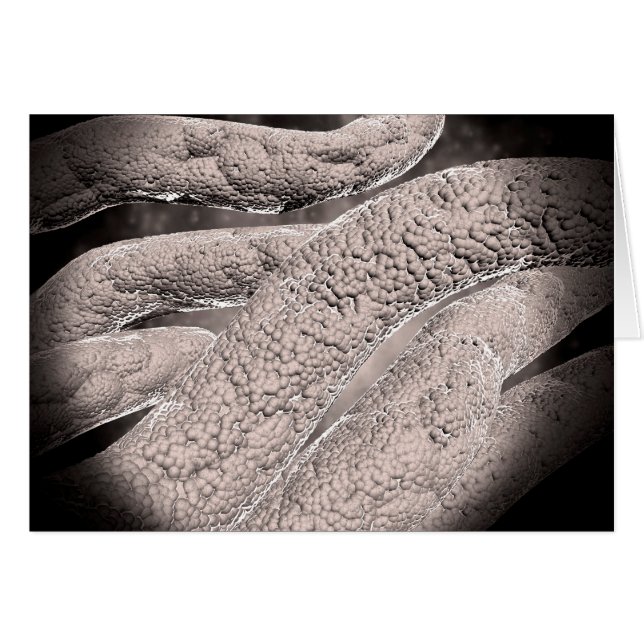 Mikroskopische Darstellung der Corncob-Formation (Vorderseite (Horizontal))