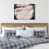 Mikroskopische Darstellung der Corncob-Formation Leinwanddruck (Insitu (Schlafzimmer))