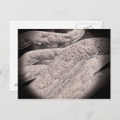 Mikroskopische Darstellung der Corncob-Formation Postkarte (Vorne/Hinten)