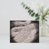 Mikroskopische Darstellung der Corncob-Formation Postkarte (Stehend Vorderseite)