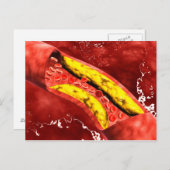 Mikroskopische Darstellung der Fettschicht innerha Postkarte (Vorne/Hinten)