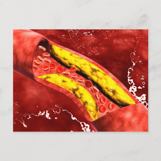 Mikroskopische Darstellung der Fettschicht innerha Postkarte (Vorderseite)