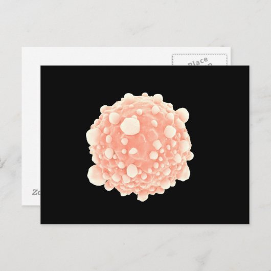 Mikroskopische Darstellung der Pankreaskrebszelle Postkarte (Vorne/Hinten)