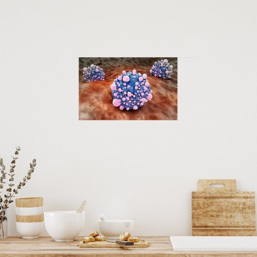 mikroskopische Darstellung der Pankreaskrebszellen Poster (Küche)