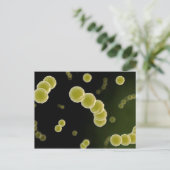 Mikroskopische Darstellung des Streptokokkus 1 Postkarte (Stehend Vorderseite)