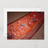 Mikroskopische Darstellung einer Blutinfektion Postkarte (Vorne/Hinten)